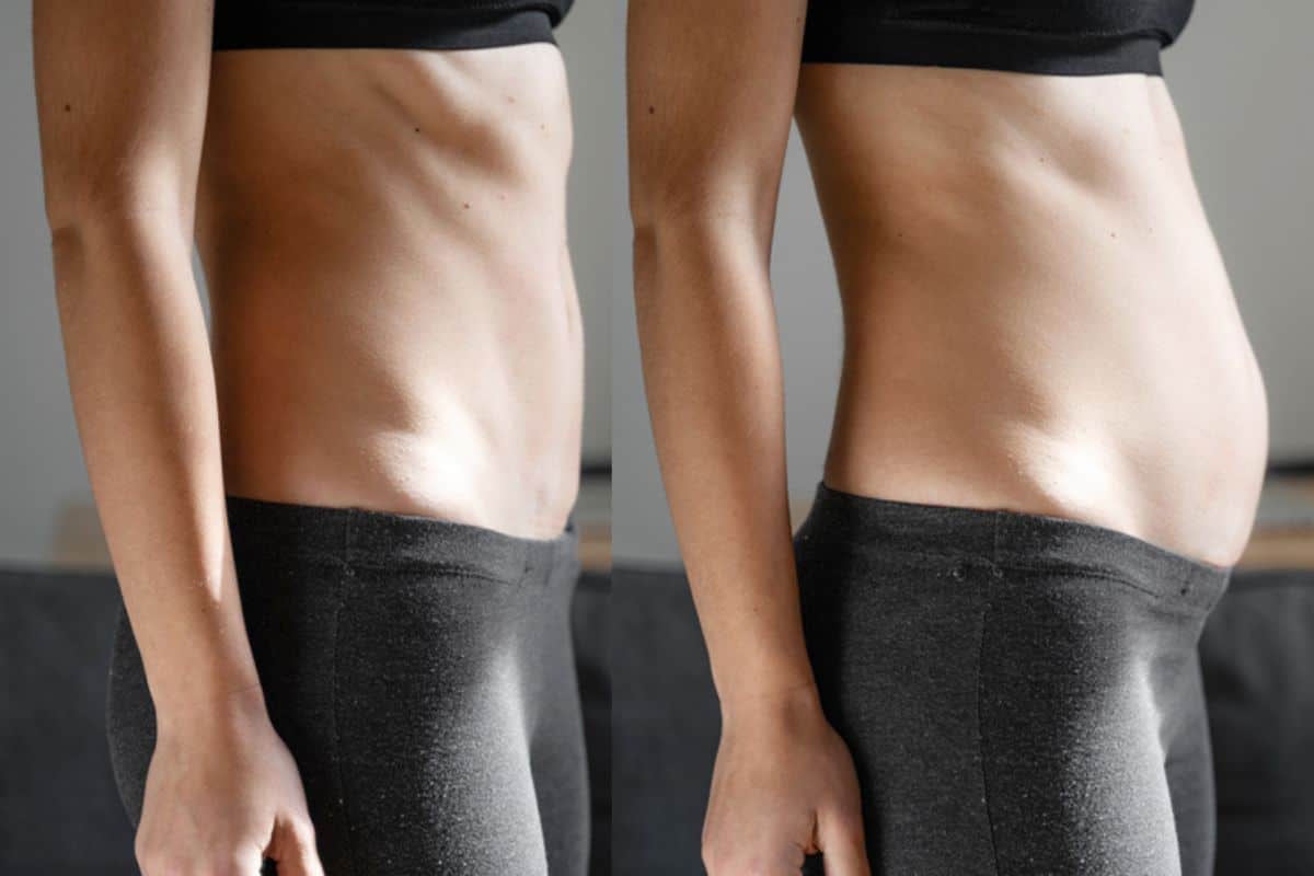 How long does diastasis recti take to improve Manchester?