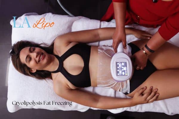 woman getting cryolipolysis Manchester