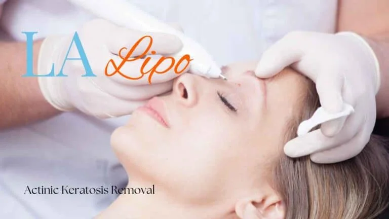 Woman receiving Actinic Keratosis Removal Treatment Manchester