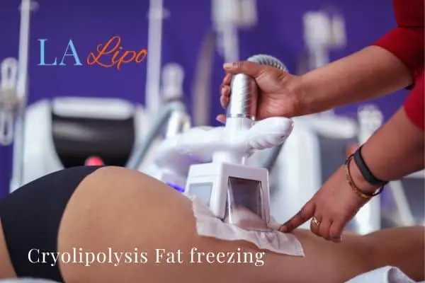 women getting fat freezing Manchester