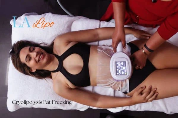 woman getting cryolipolysis Manchester