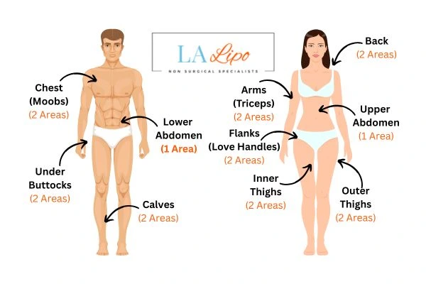 LA LIPO Cryolipolysis Areas Manchester