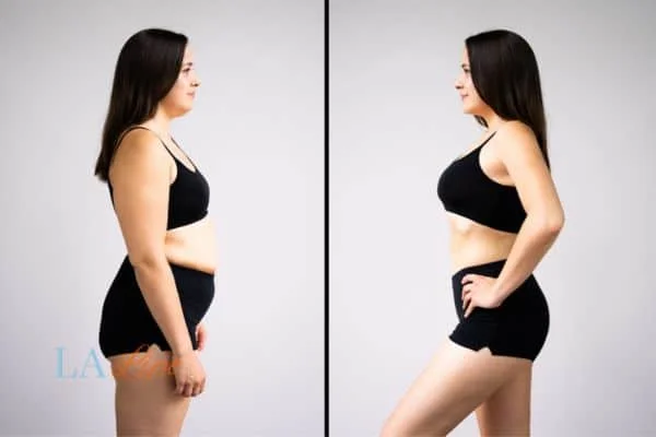 link between body image and mental health Manchester
