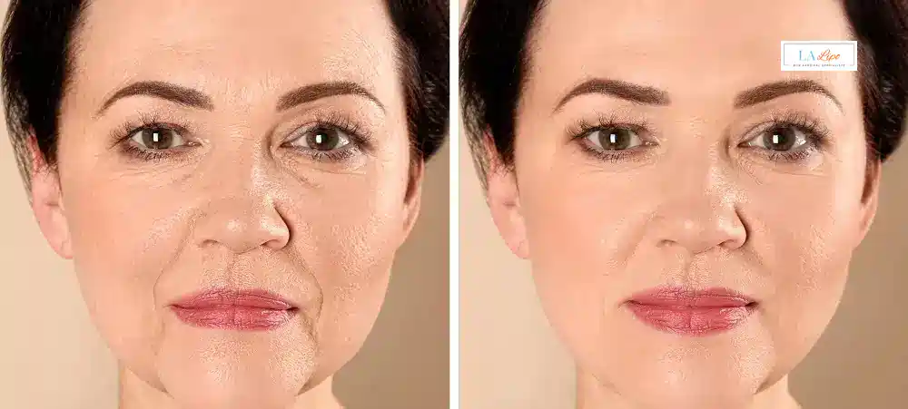 How Long Does It Take to See Results and How Long Do They Last Manchester?
