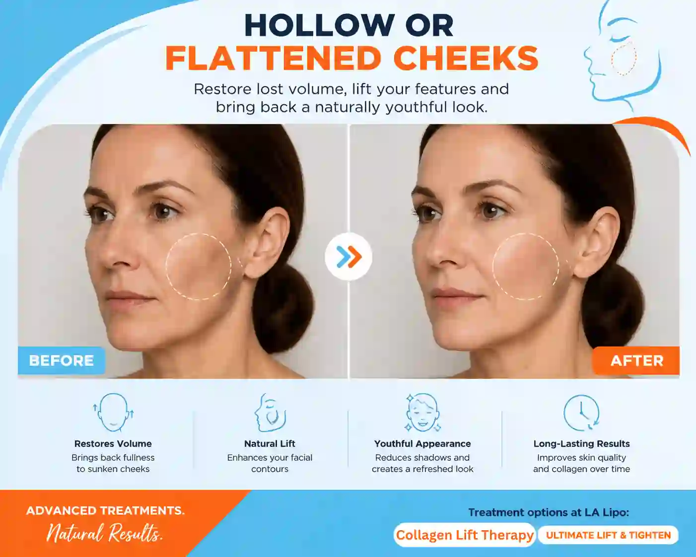 Sign #4: Hollow or Flattened Cheeks Manchester
