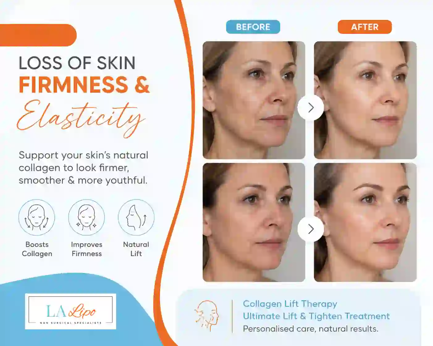 Sign #7: Loss of Skin Firmness and Elasticity Manchester